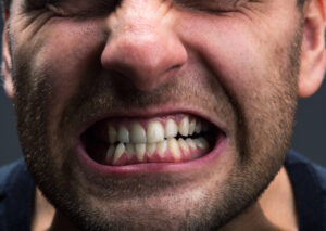Bruxism and its psychological implications